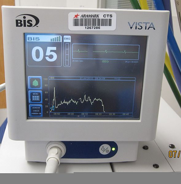 Anesthesia Awareness and the Bispectral Index