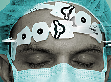 Clinical Topic: Bis and Postoperative Cognitive Dysfunction